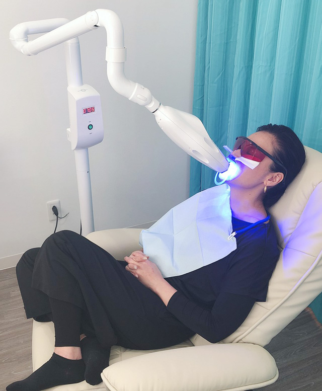 セルフホワイトニング